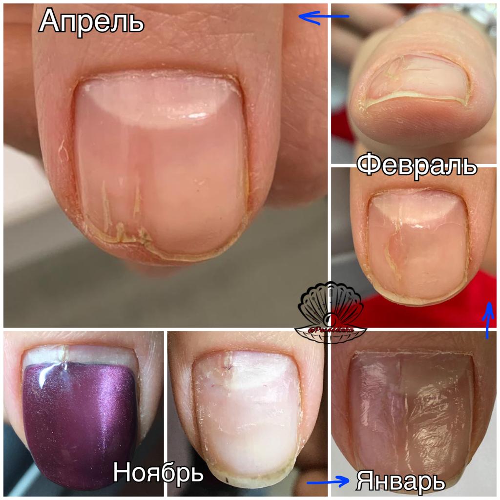 ≡ Проблемы при покрытии ногтей гель-лаком: в помощь начинающим мастерам — блог Naomiua